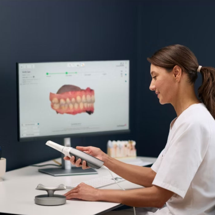 Intraoral Scanner